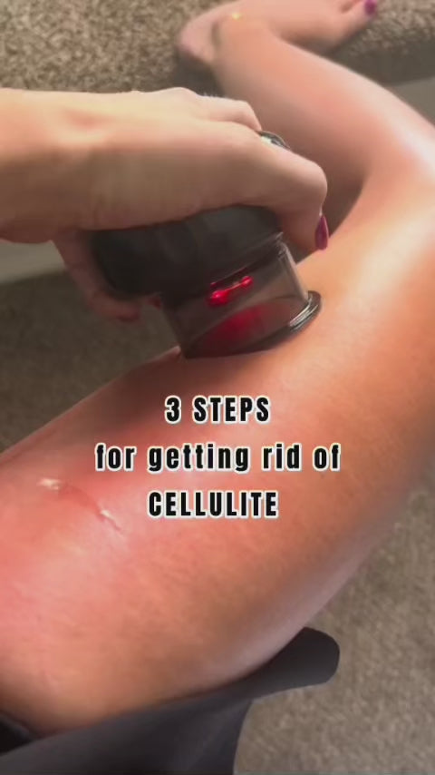 TheraPulse™ – Smart Decompression Cupper video